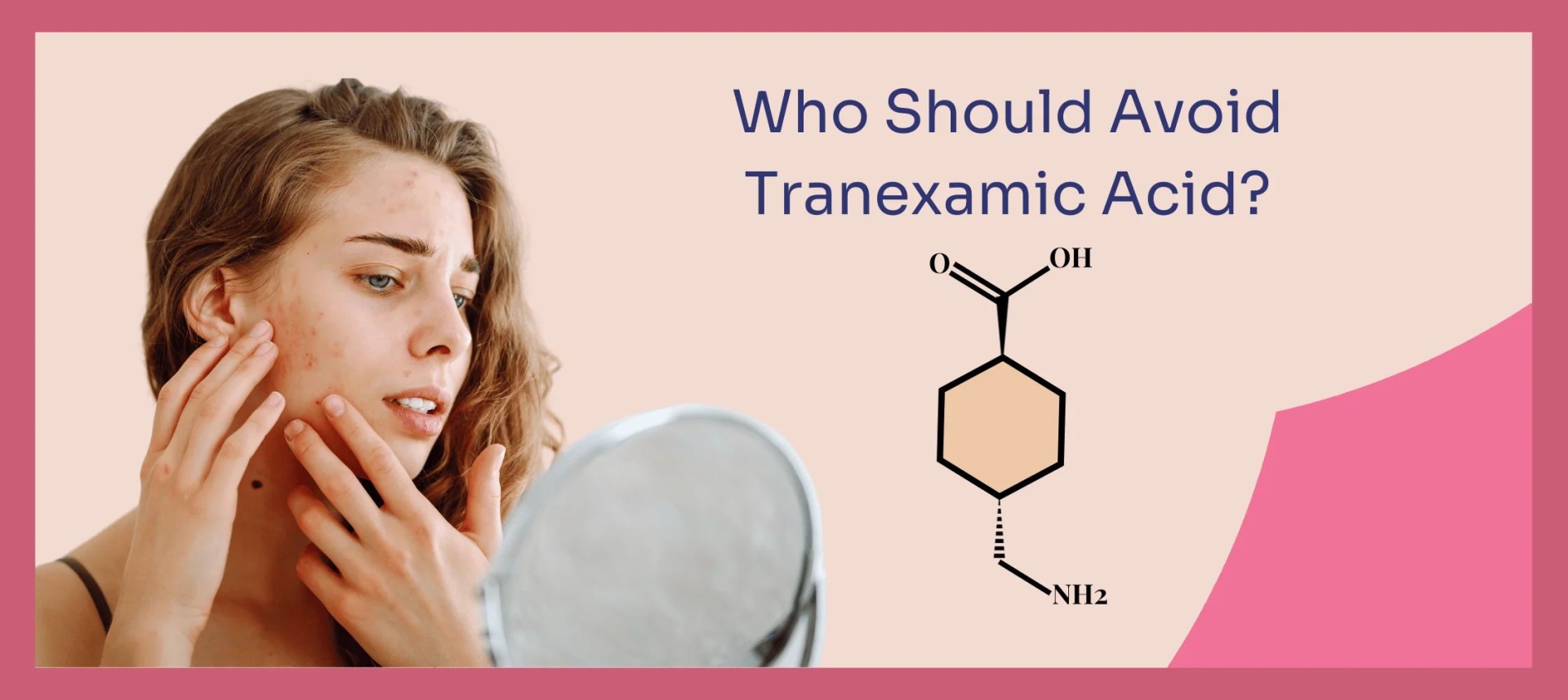 网红“氨甲环酸”被批准用于色斑治疗了吗？